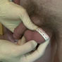 My first sex procedure